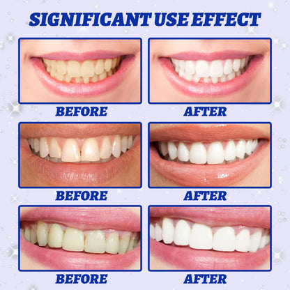 5D Teeth Whitening Strips - 7pcs